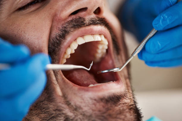 Best Emergency Dental Surgery in Manti, UT