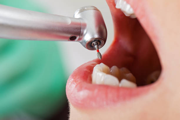 Best Emergency Broken Tooth Repair in Manti, UT